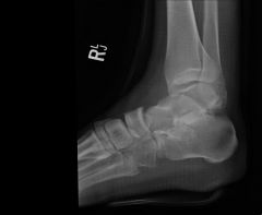 befor sugery 4.jpg