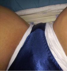 Panties with diapers