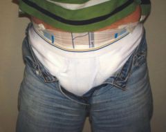 Tighty Whities over soaked Diapee