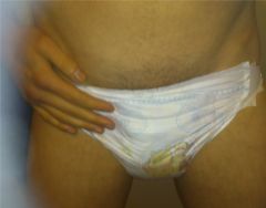Huggies Super Dry
