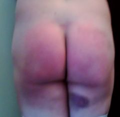 ...my bruised butt