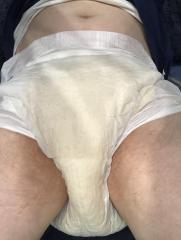 Me in My First BetterDry Diaper - Crotch View