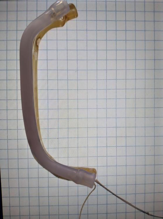 stent-1.jpg