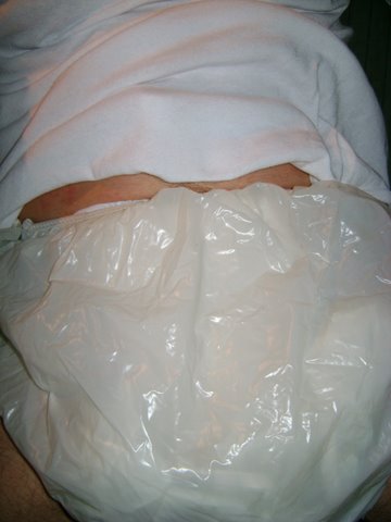 diapersrhot
