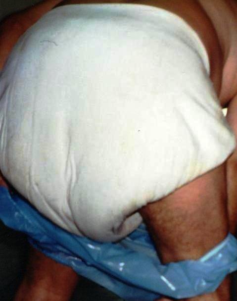 One set of my regular daytime cloth diapers with blue Comco plastic panties
Not too thick to fit under pants or shorts.  Yet, they'll take repeated usage all day, with never any worries about ever having wetspots showing or needing to change diapers until back at home.  Sure, everyone will recognize your obvious diaperlines showing through.  SO?! Nothing's ever happened to me, and i've been wearing diapers like these all of my life!  
Keywords: public_cloth_diapers_plastic_uninhibited_wet.